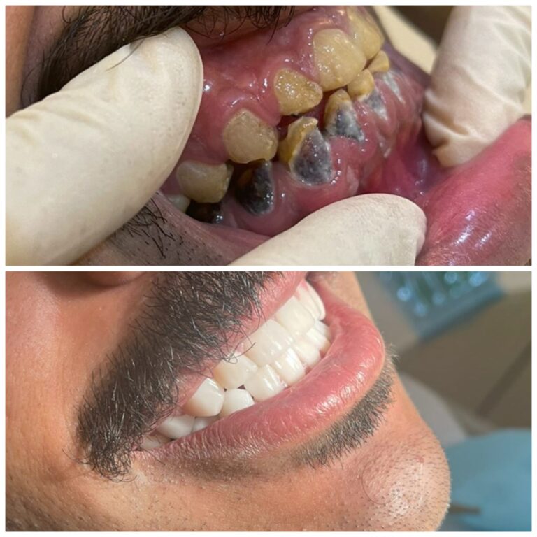 حالة أسنان 2